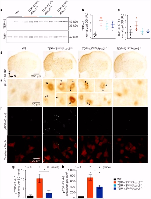 Therapeutic reduction of ataxin 2 extends lifespan and reduces